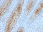  Beta-2 Microglobulin (Renal Failure & Tumor Marker) Antibody - With BSA and Azide
